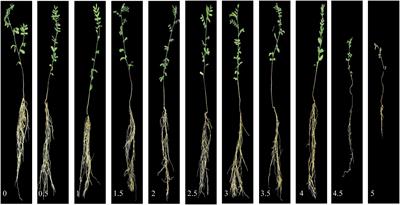 Advanced Imaging for Quantitative Evaluation of Aphanomyces Root Rot Resistance in Lentil